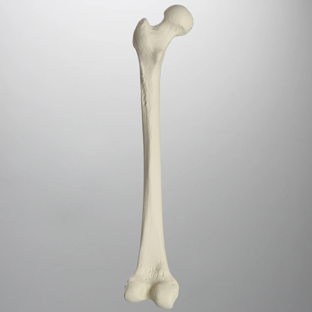 <p>Left or right bone</p>