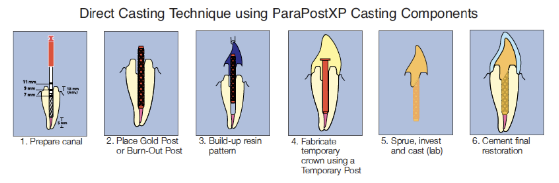 <ol><li><p>prepare canal</p></li><li><p>place gold post or burn-out post </p></li><li><p>build-up resin pattern, then remove </p></li><li><p>fabricate temp crown using a temp post </p></li><li><p>take build-up resin pattern to lab to sprue, invest and cast </p></li><li><p>cement final restoration </p></li></ol><p></p>