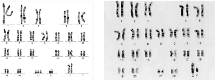 <p>is this a normal karyotype ?</p>