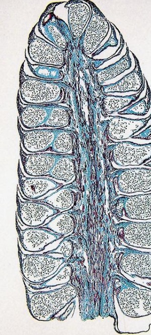 <p>Identify whether the cone is male or female.</p>