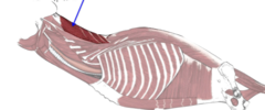 <p>What muscle, part of the transversospinalis system, is shown?</p>