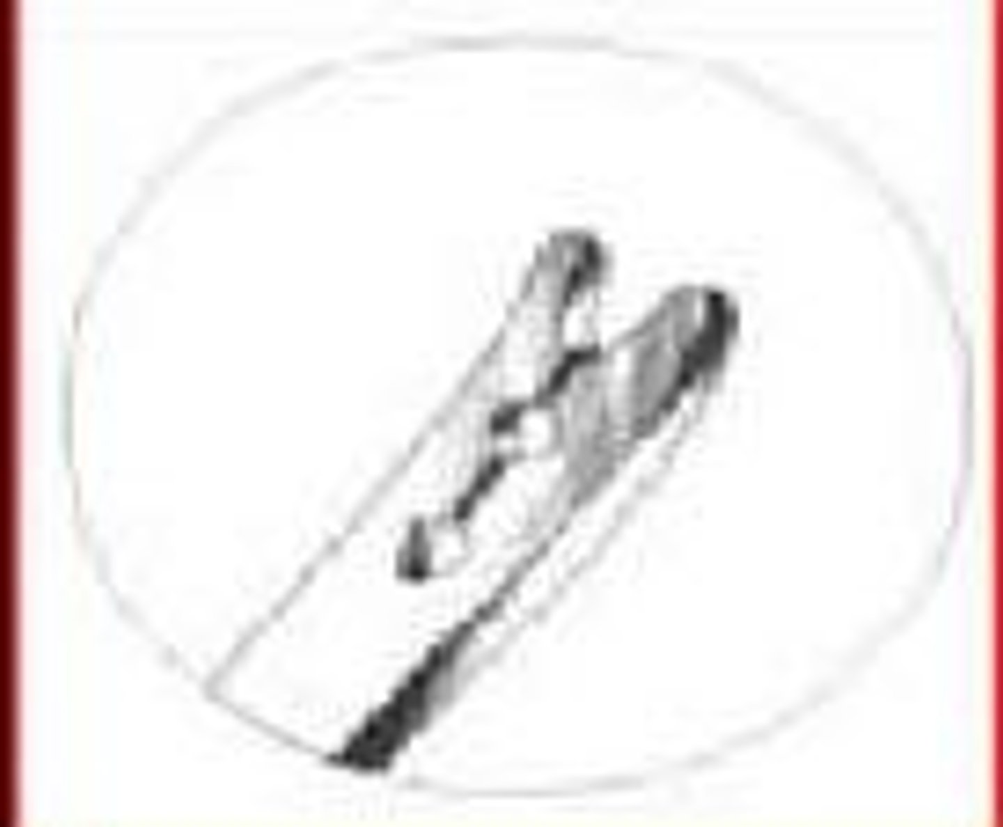<p>-curved taper (fine); used on intestine</p><p>- also referred to as a spring or split eye</p><p>-the suture strand is pulled through the slit to secure.</p><p>-This needle must be used with pliable, braided material such as silk, or with cotton suture in a medium to fine size.</p><p>-French eye needles are not practical to be used with surgical gut, because they may fray the suture.</p>