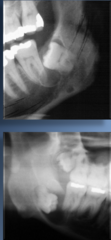 <p>What cyst is this?</p>