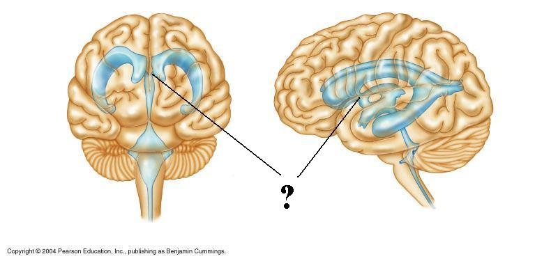 <p>Identify the indicated opening</p>
