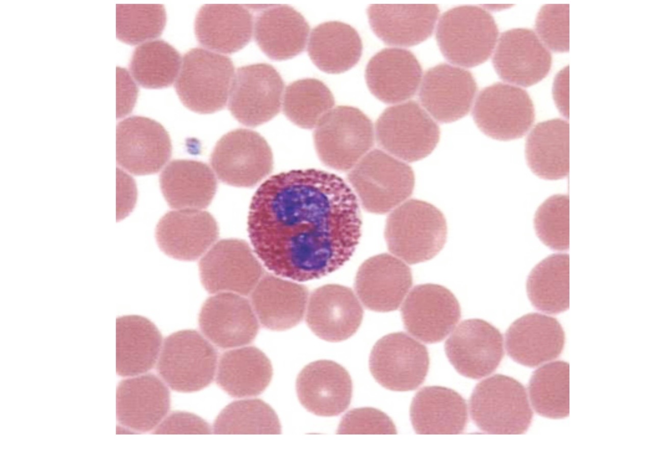 <p>What is the name of the following WBC? What is it involved in?</p>