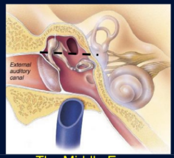 <p>epitympanic recess- above the line </p><p>tympanic cavity- below the line </p>