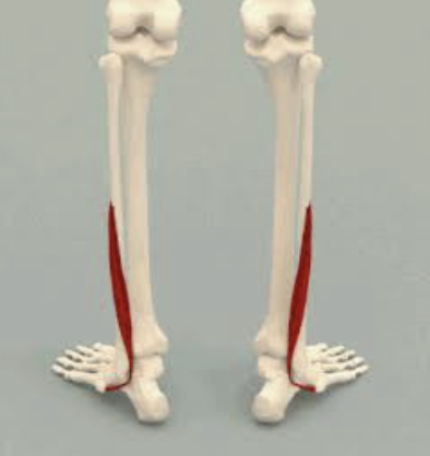 <p>Which muscle is this?</p>