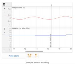 <p>12 to 16 bpm.</p>