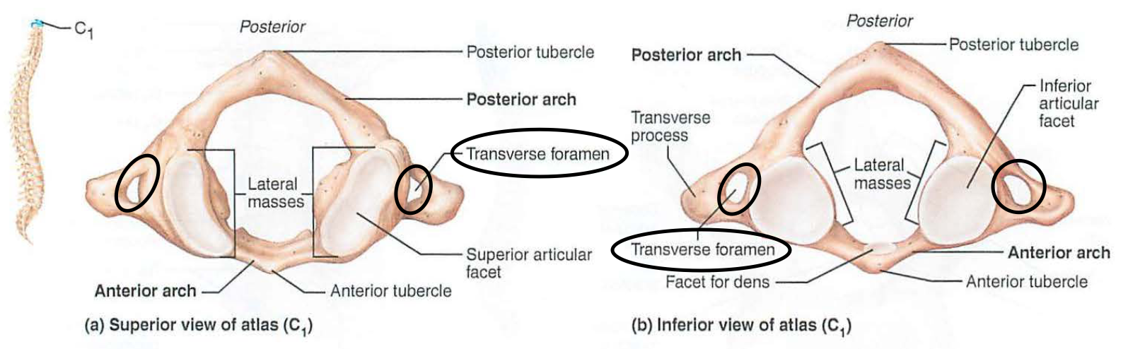 <p>c. transverse foramina</p>