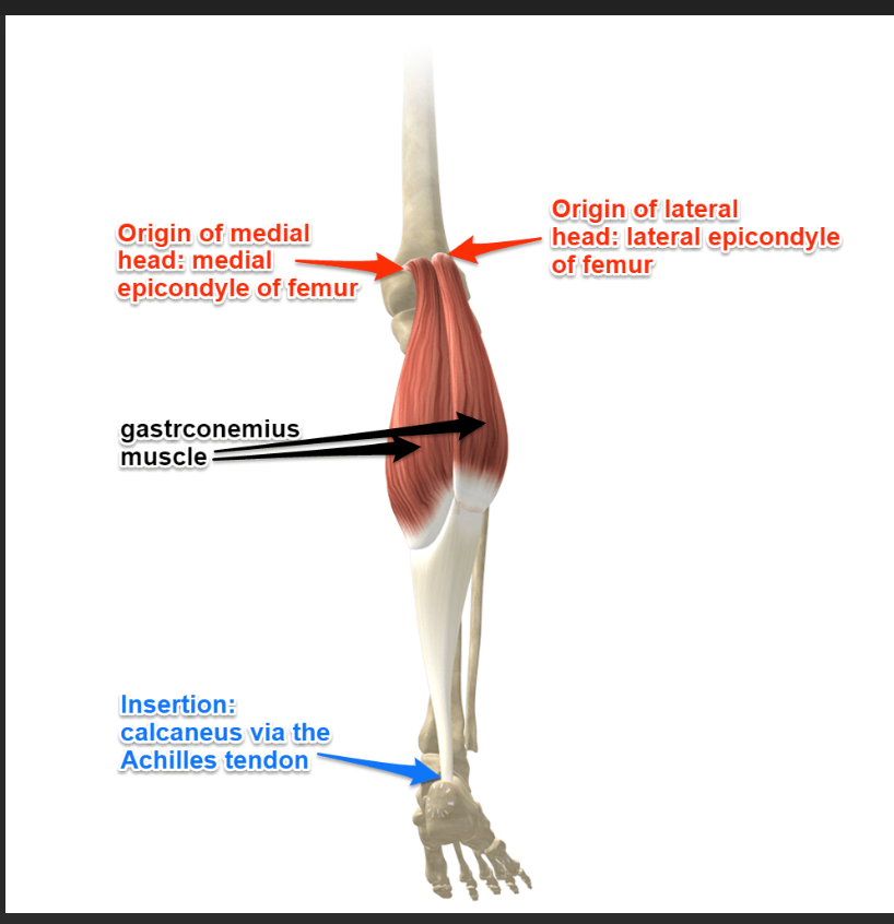 <p>Gastrocnemius (posterior leg) insertion </p>