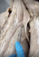 <p>Name the Muscle</p><p>- specific area of iliocostalis</p>