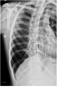 <p><span style="background-color: transparent;">OBL ribs</span></p>