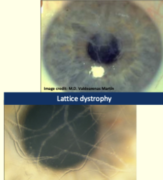 <p>Describe and give diagnosis </p>
