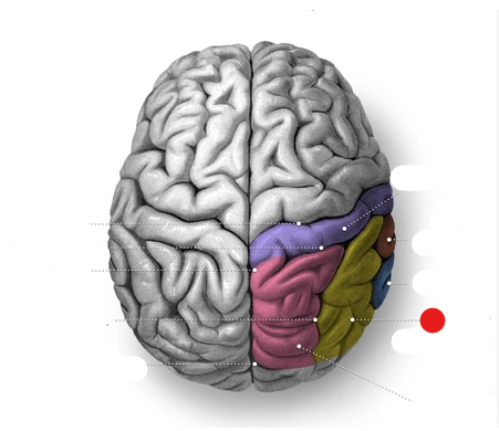 <p>Identify the structure pinned</p>