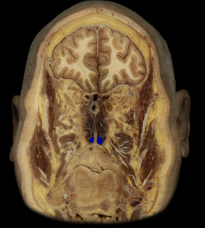 term image
