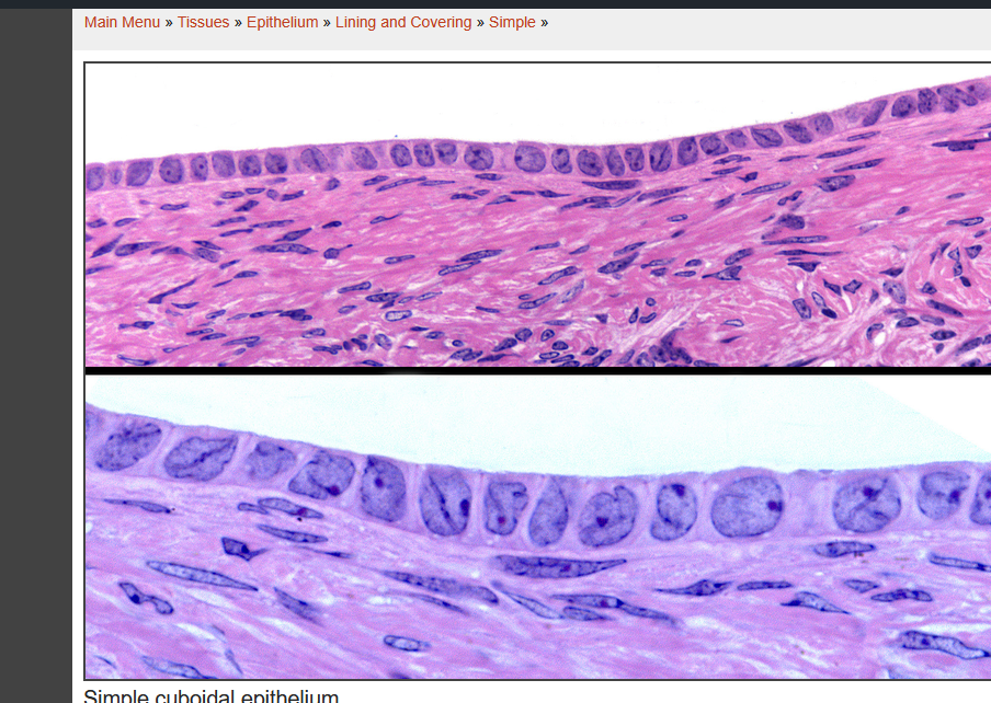 <p>what tissue type is this</p>