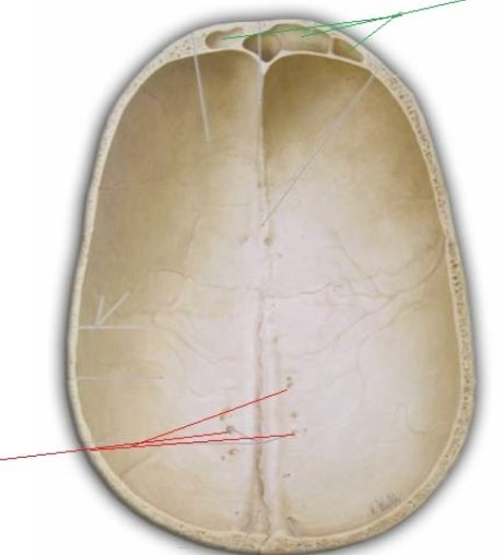 <p>What Causes the Holes highlighted by red lines</p>