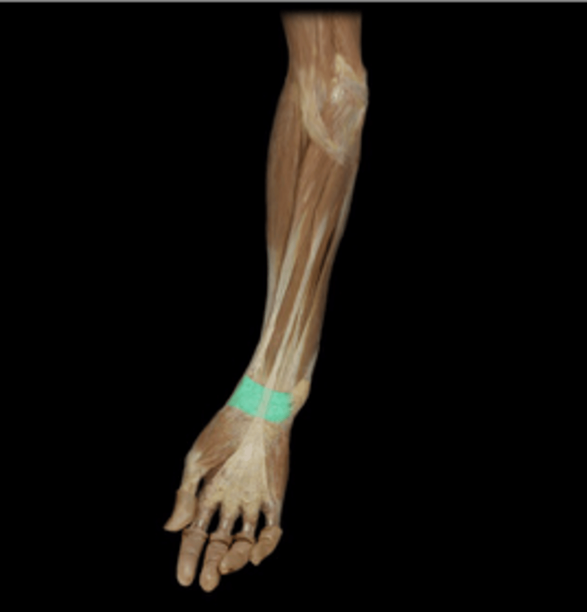 <p>What structure is indicated in green?</p>