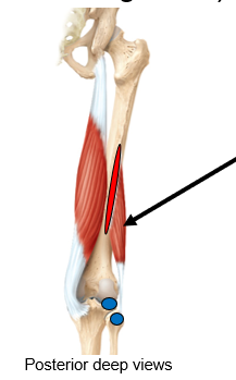 <p>What does the red-lighted area represent? is it an origin/insertion; for what muscle of the biceps femoris?</p>