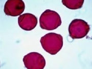 <p>what type of pollen? </p>