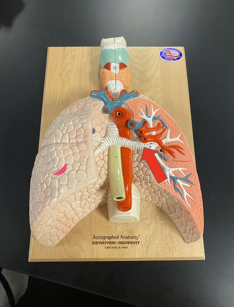 <p>Identify the highlighted structure (space between rings, inside lungs)</p>