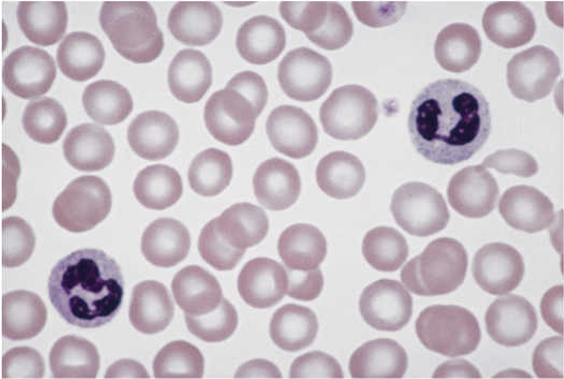 <p>Circle with Purple Dots</p>