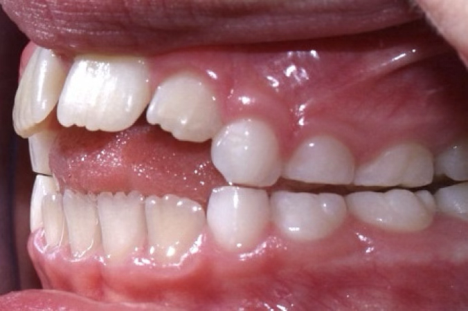 <p>Define this condition</p>