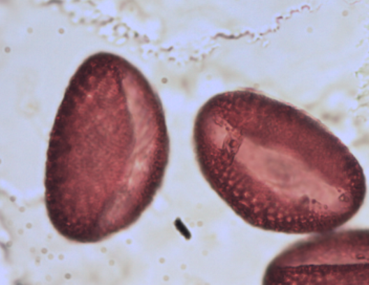 <p>Identify the pollen grains to the <strong>Family </strong>level</p>