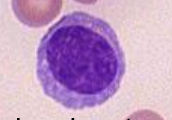 <p>What blood cell is this?</p>