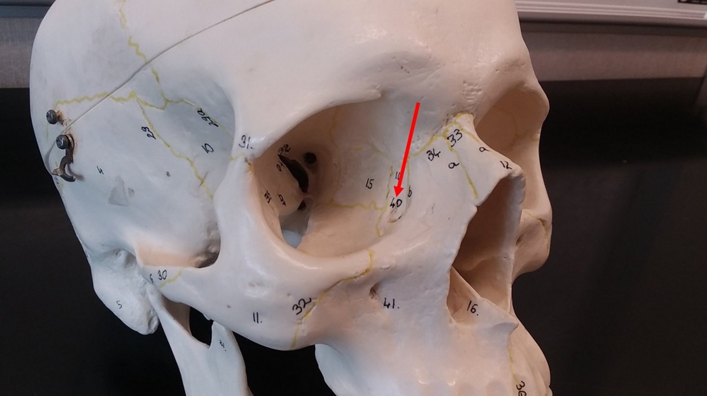 <p>What bone is this?</p>