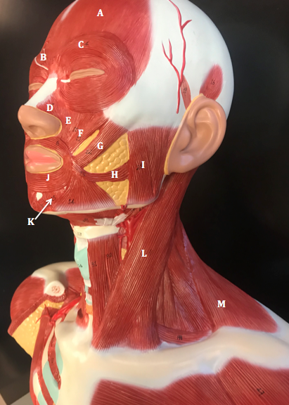 <p><span>Identify the muscle labeled "</span><strong>H</strong><span>"</span></p>