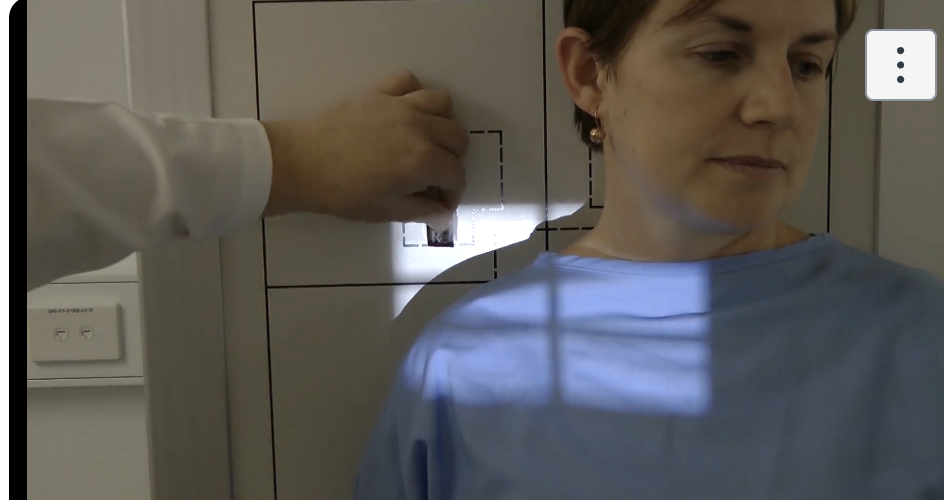 <p>patient erect with back against the erect bucky, slight rotation AWAY from the side of interest so the clavicle is parallel with the IR</p>