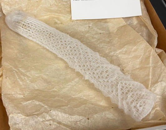 <p>What is this? What Class and phylum is it part of?</p>