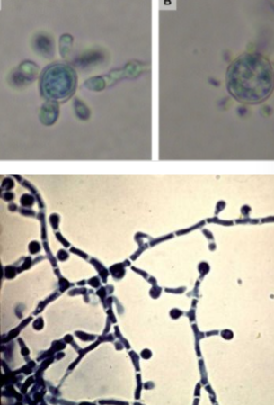 <p>Mariners wheel yeast, septate hyphae</p>