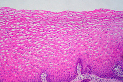 <p>Layered</p>