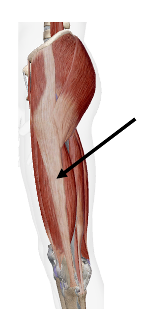 <p>The _____ is formed from the fascia of the gluteus maximus muscle and the tensor fascia latae.</p>