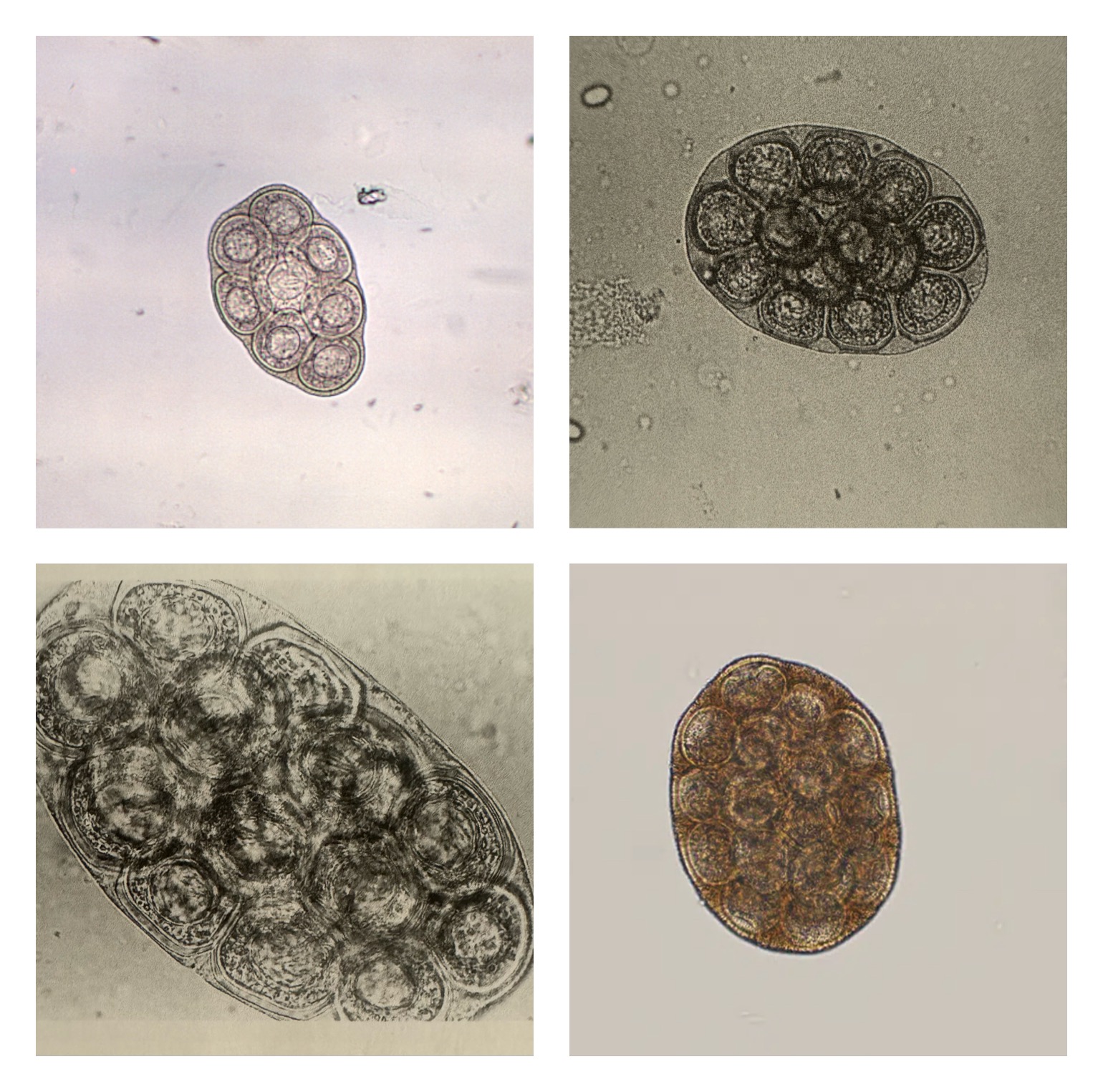<p>Dipylidium caninum ovum</p>