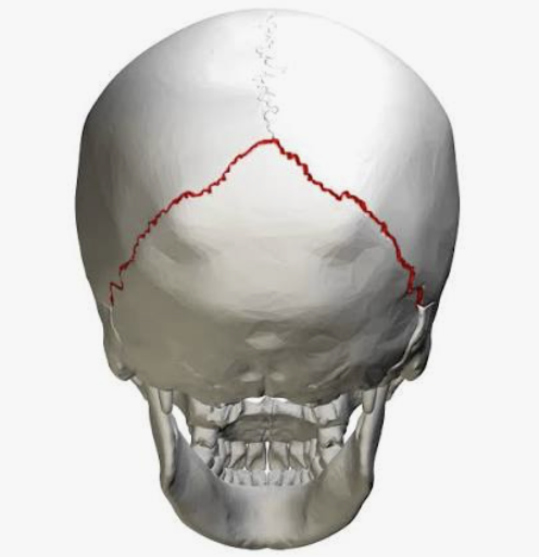 <p>Which suture is this?</p>
