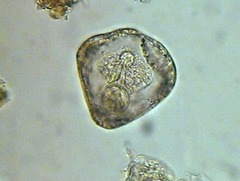 <p>Moniezia (anaplocephalid tapeworm)</p><p>**generally non-pathogenic</p>