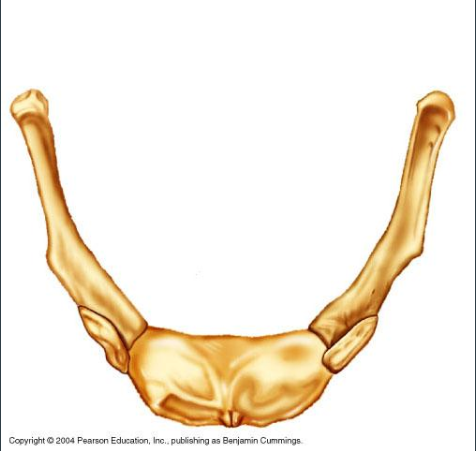 <p><span>Identify the indicated bone.</span></p>