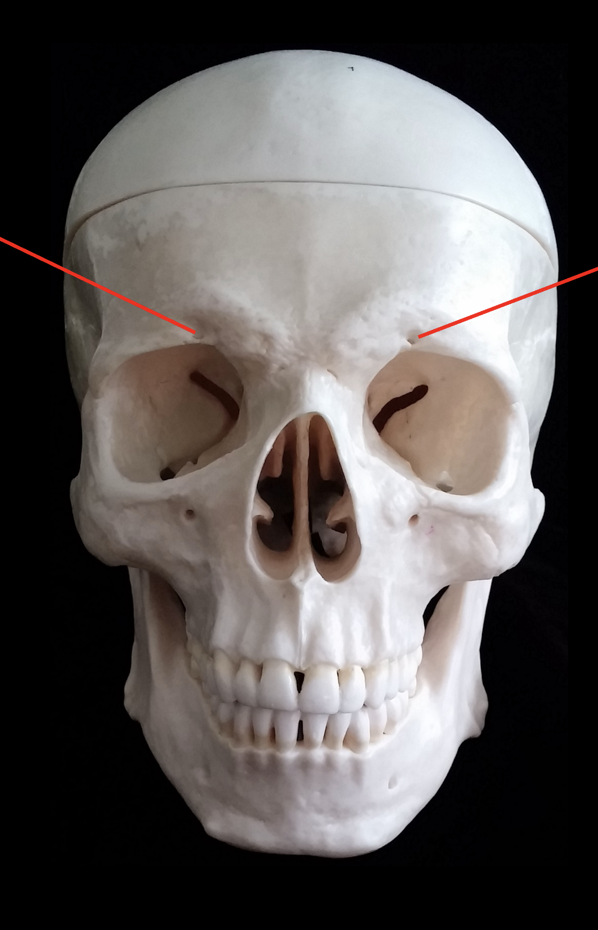 <p>What is the bone pointed at by the two arrows on the Frontal bone?</p>