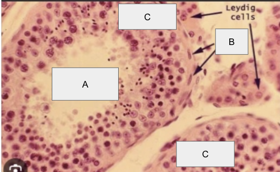 <p>A</p>