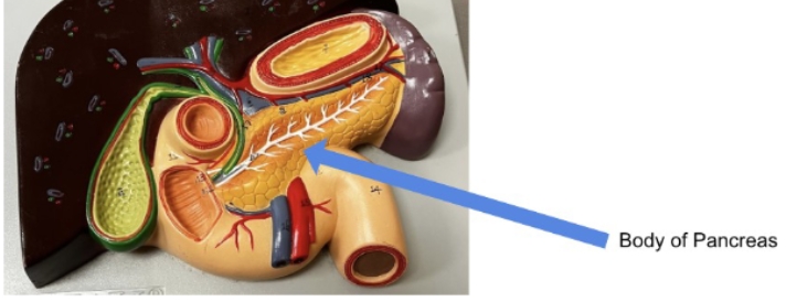 <p>body of pancreas</p>