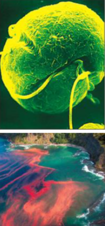 <p><mark data-color="yellow" style="background-color: yellow; color: inherit;">A photosynthetic </mark>(contains chlorophyll) <mark data-color="yellow" style="background-color: yellow; color: inherit;">Eukaryote that can be </mark><u><mark data-color="yellow" style="background-color: yellow; color: inherit;">unicellular</mark></u><mark data-color="yellow" style="background-color: yellow; color: inherit;"> (</mark><strong><mark data-color="yellow" style="background-color: yellow; color: inherit;">microscopic</mark></strong><mark data-color="yellow" style="background-color: yellow; color: inherit;">) or </mark><u><mark data-color="yellow" style="background-color: yellow; color: inherit;">multicellular</mark></u><mark data-color="yellow" style="background-color: yellow; color: inherit;"> (</mark><strong><mark data-color="yellow" style="background-color: yellow; color: inherit;">macroscopic</mark></strong><mark data-color="yellow" style="background-color: yellow; color: inherit;">)</mark></p><ul><li><p>found in both fresh and salt water, alongside soil</p></li><li><p>rigid cell wall is made out of <strong><mark data-color="purple" style="background-color: purple; color: inherit;">cellulose</mark></strong></p></li></ul><p></p><p><u>has various types:</u></p><img src="https://assets.knowt.com/user-attachments/ab5b9ede-e105-4957-8409-2ce6ae984528.png" data-width="100%" data-align="center"><p>[__] doesn’t cause disease directly</p><ul><li><p>has toxins which are poisonous to humans → cause disease</p></li><li><p><strong><mark data-color="purple" style="background-color: purple; color: inherit;">seasonal algal blooms</mark></strong>: a rapid increase in population of microscopic algae in a body of water</p><ul><li><p><u><mark data-color="purple" style="background-color: purple; color: inherit;">eg.</mark></u><mark data-color="purple" style="background-color: purple; color: inherit;"> “Red tide”</mark><mark data-color="yellow" style="background-color: yellow; color: inherit;"> caused by </mark><strong><mark data-color="yellow" style="background-color: yellow; color: inherit;">dinoflagellates</mark></strong></p><ul><li><p>» when shellfish eat the dinoflagellates, they produce neurotoxins</p></li><li><p>» humans ingesting shellfish suffer paralytic shellfish poisoning → die primarily from respiratory failure</p></li></ul></li></ul></li></ul><p></p>