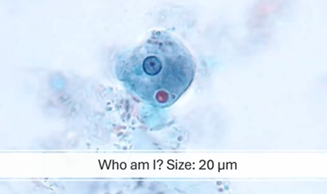 <p><span style="background-color: rgba(0, 0, 0, 0); line-height: 19.7625px;">What is the species seen in this photo and WHY?</span></p>