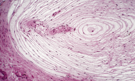 <p>what touch receptor is this?</p>