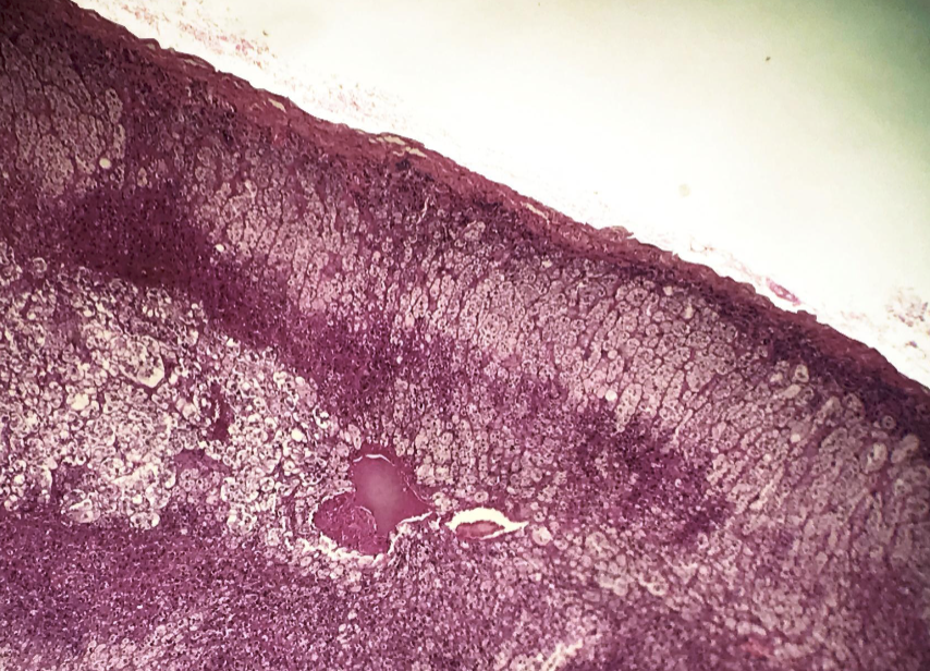 <p>adrenal: capsule, adrenal cortex, zona glomerulosa, zona fasciculata, zona reticularis, adrenal medulla</p>