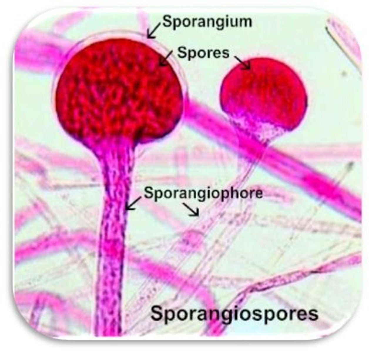 <p>the case/sac that contains millions of spores</p>