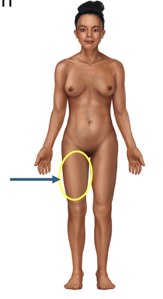 <p>Name the body part or region</p>