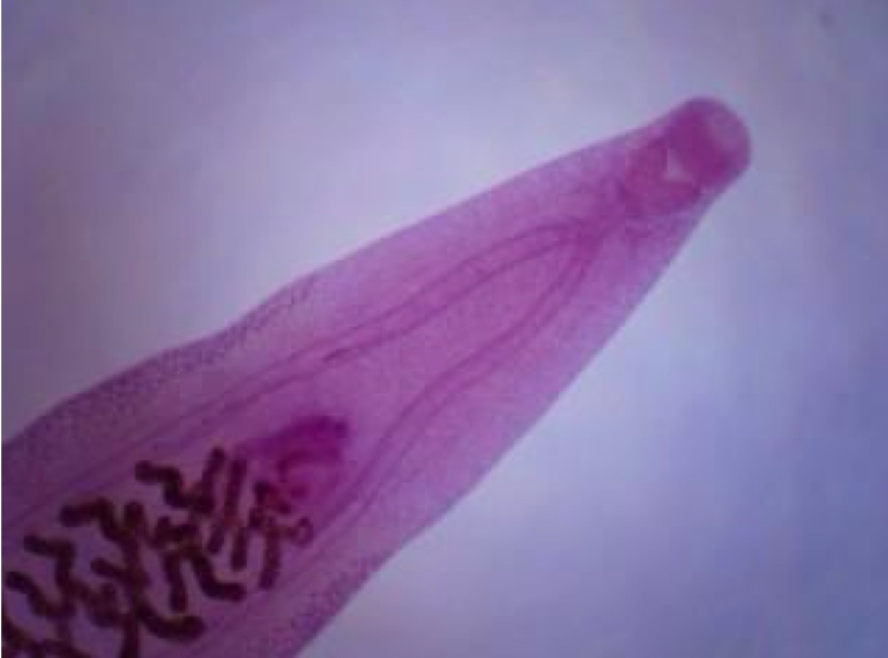 <p>Phylum: platyhelminthes</p>